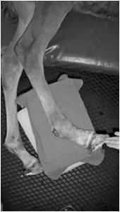 Tendon Laxity Treatment With shoes