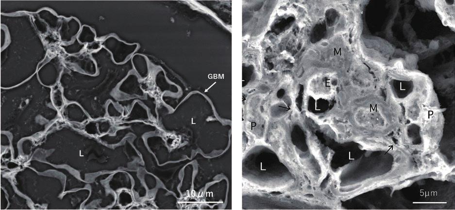 Clear contrast, which cannot be obtained in LV-SEM images with the usual stained specimens for LM observation, can be obtained by using a heavy-metal stain to image in the backscattered electron mode.