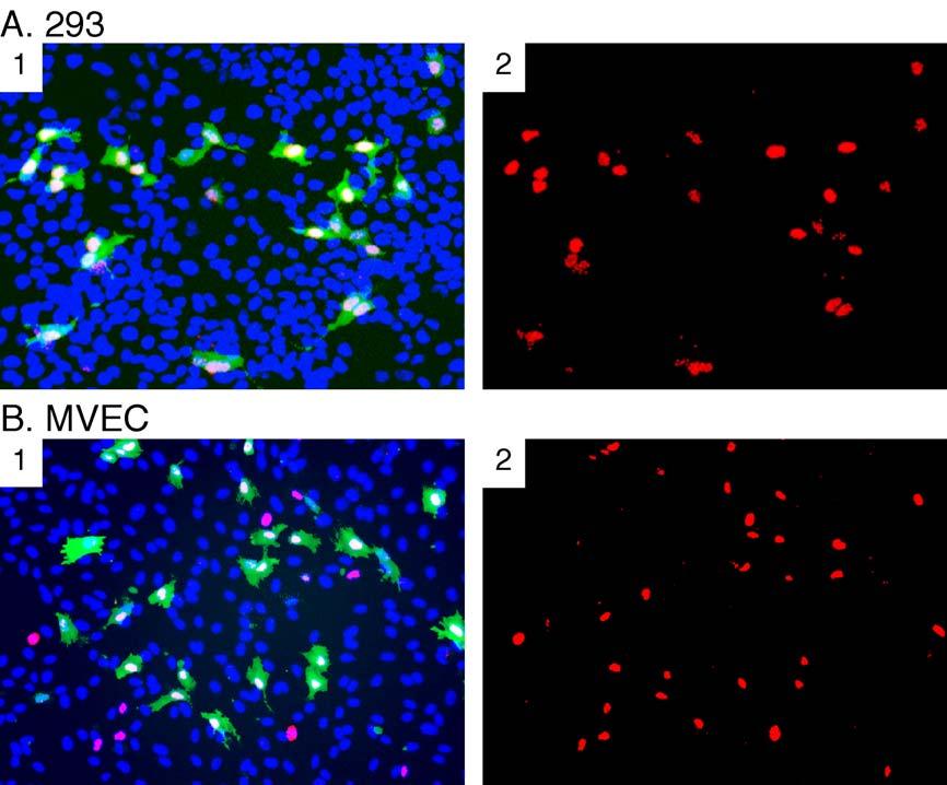 (A2) Image of the immunofluorescence detection of LANA in 293 cells, alone. (B1) MVEC, 5 days postinfection with rkshv.