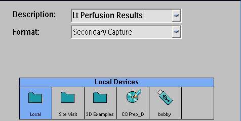 4. Advance forward to Perfusion Maps. Post Processing 5.