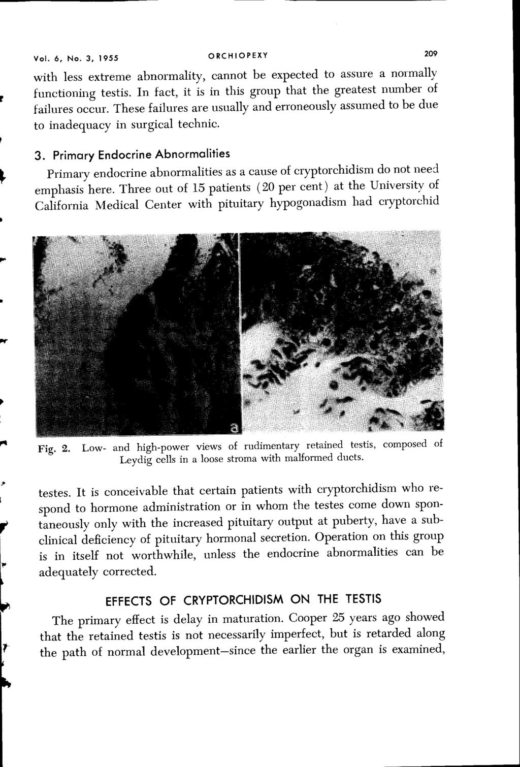 Vol. 6, No.3, 1955 ORCHIOPEXY 209 with less extreme abnormality, cannot be expected to assure a normally functioning testis. In fact, it is in this group that the greatest number of failures occur.