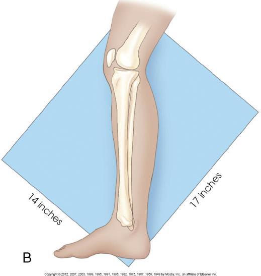 Patient Position: LEG Lateral Projection Part Position: