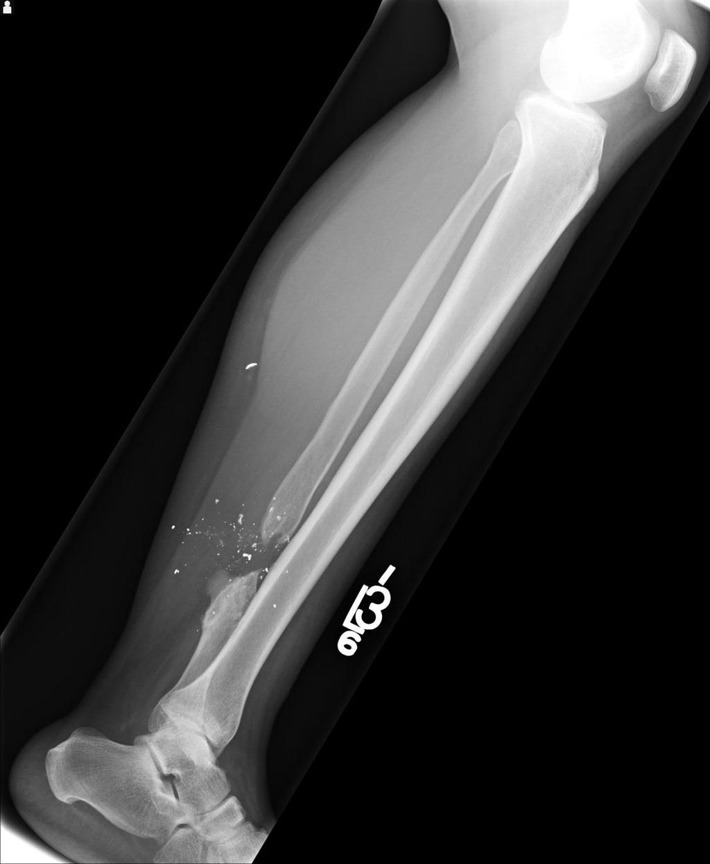 Structures Shown: Criteria for Evaluation: The of the leg should be in alignment with
