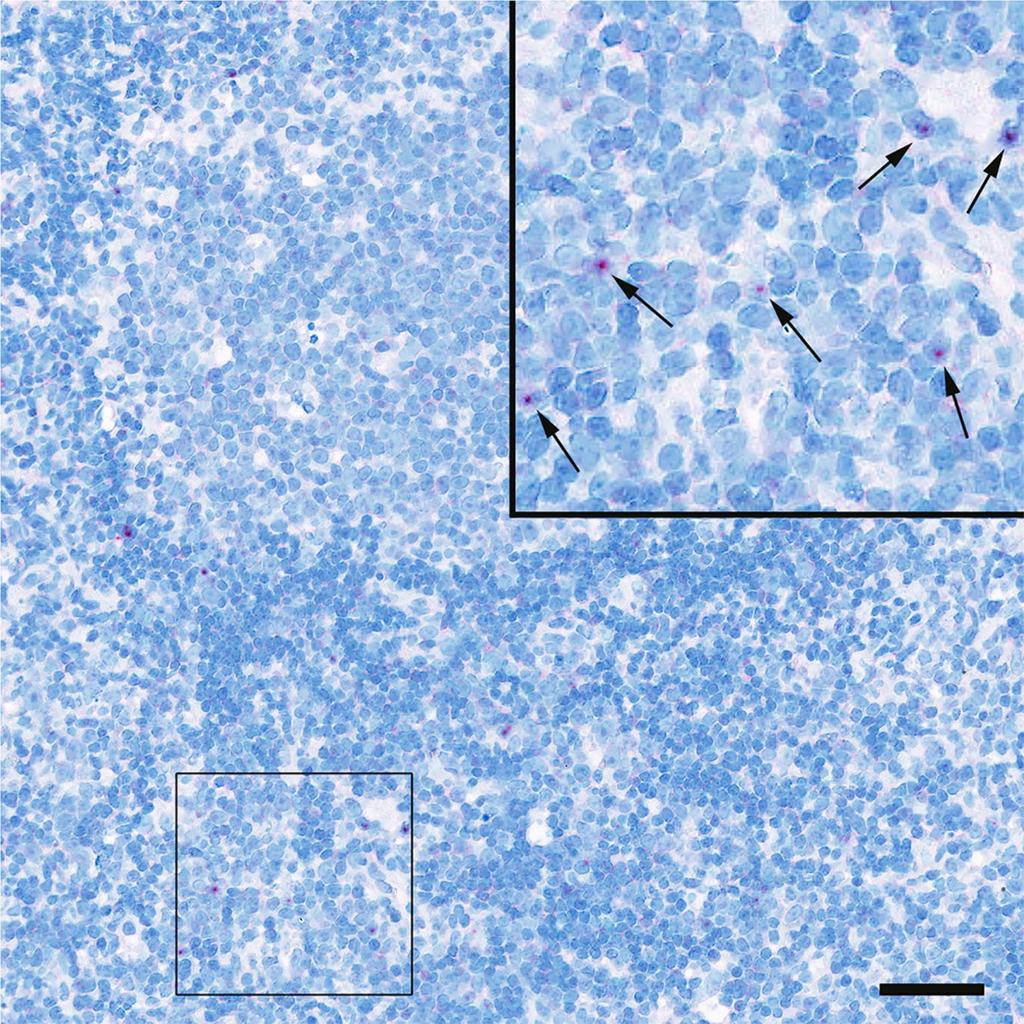 Supplementary Figure 3. Representative images from brain, kidney, liver, and lymph node using 35S SIV RNA ISH (red arrows) and SIV RNAscope (black arrows) to identify vrna+ cells.