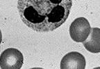 cells & tumor cells Note the smaller NK cell destroying its target cell by pore forming perforins Cells in the Innate System (2) Phagocytic