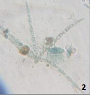 Septate, not constricted at the septa. Main axis 44-66 µm long and 3.5-5µm at the widest point.