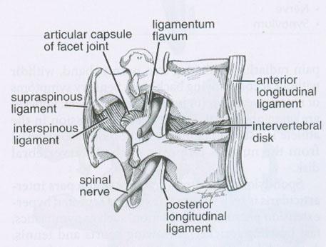 One example of an inflamed nerve is when either the lumbar joints or sacroiliac joints become