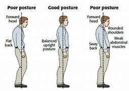 4.) POOR POSTURE AND POOR GAIT- Poor posture can lead to low back pain. 6,7,8,9 This occurs when the pelvis becomes displaced forward due to tight hip flexors, weak gluteal muscles and hamstrings.