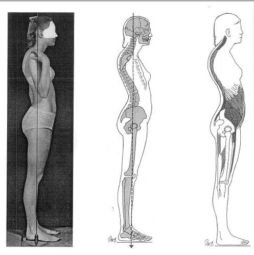 then adaptively shorten Kypholordotic Posture Tight suboccipital neck extensors, hip flexors, serratus anterior, pectorals,