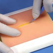 closure needs A good marketing tool to display a variety of different sutures and skin adhesives