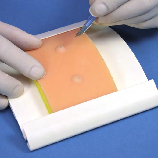 fat layer - precise replication of in-vivo adhesion - all layers of tissue can be identified Pad dimensions: 125mm x 72mm Now latex free 1 Lipoma Pad Sebaceous Cyst Pad Part No: 00071 For practising