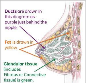 BREAST DENSITY- WHAT IT IS NOT Fibrocystic Breast tissue Lumpy & Bumpy Breasts Fatty