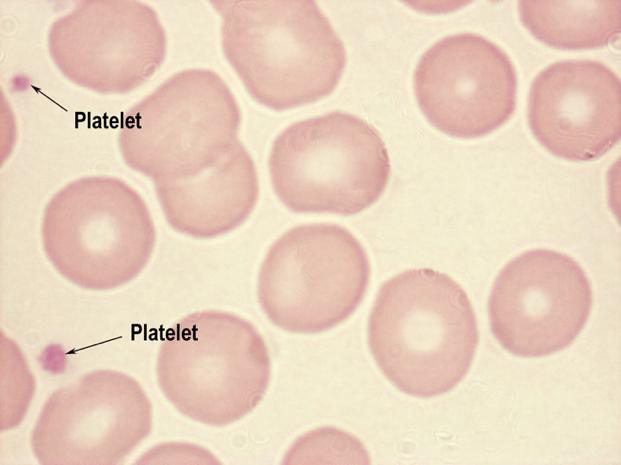 Platelet-rich plasma (PRP) Venous blood: 150,000-350,000 platelets / µl
