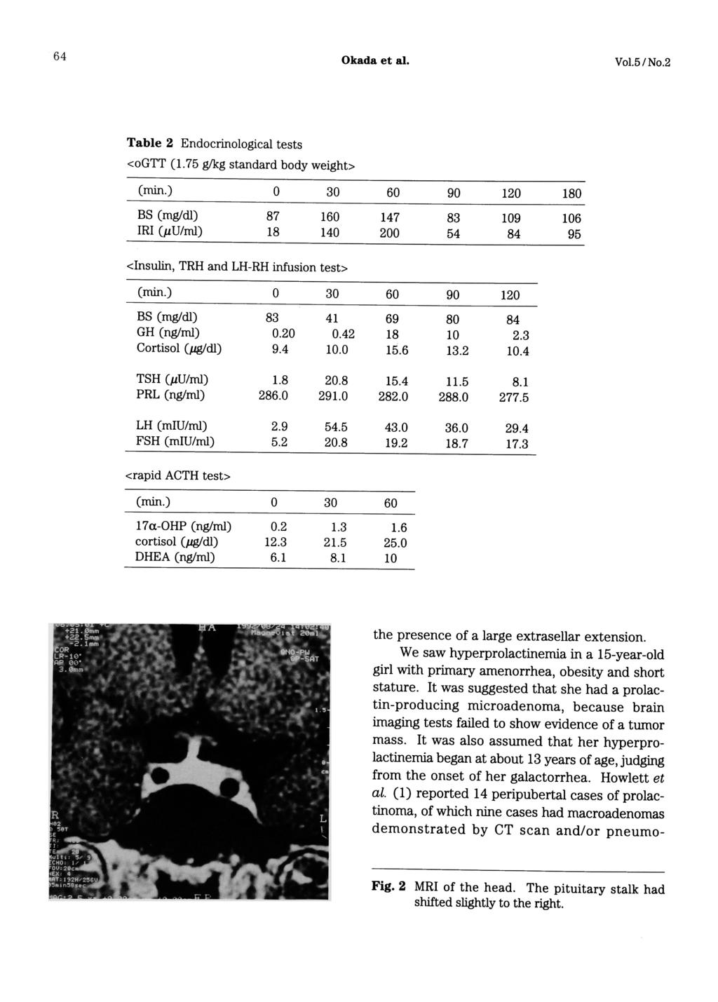 64 Okada Table 2 Endocrinological et al. Vol.5/No.2 tests the presence of a large extrasellar extension.