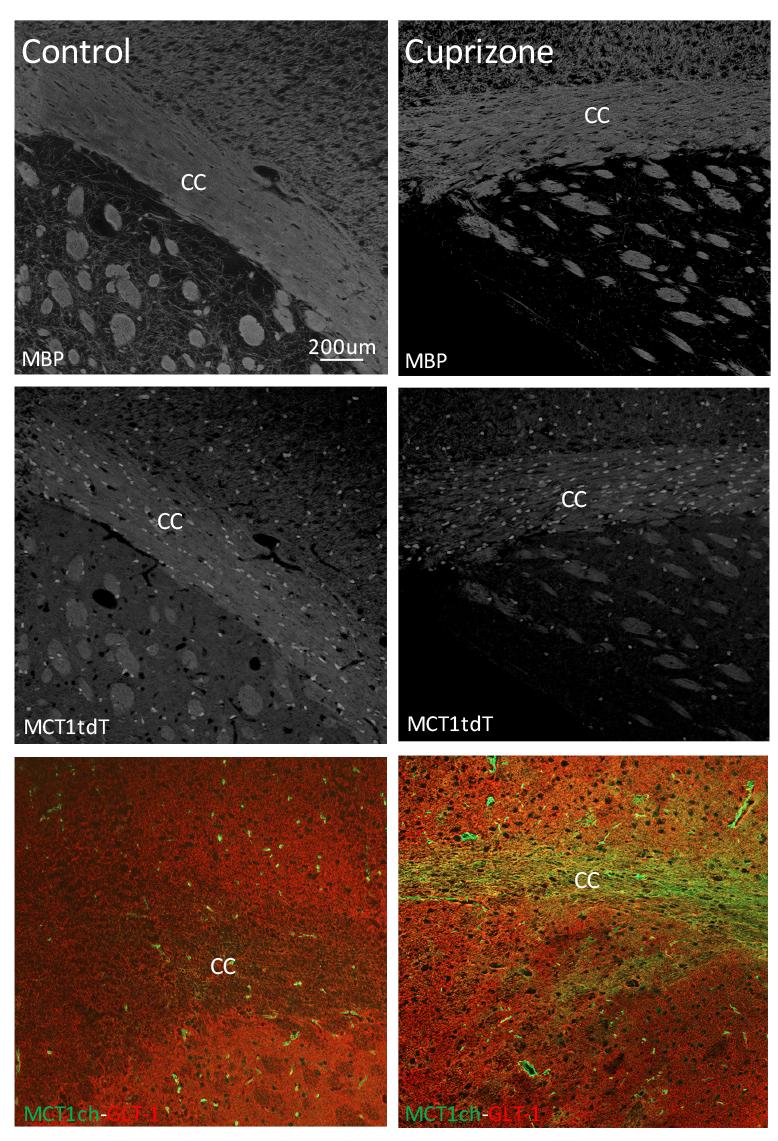localized with GLT-1 expressing astrocytes, very similar to what was found in the EAE experiments (see above), suggesting that astrocytes respond to the demyelinating insult by an upregulation of