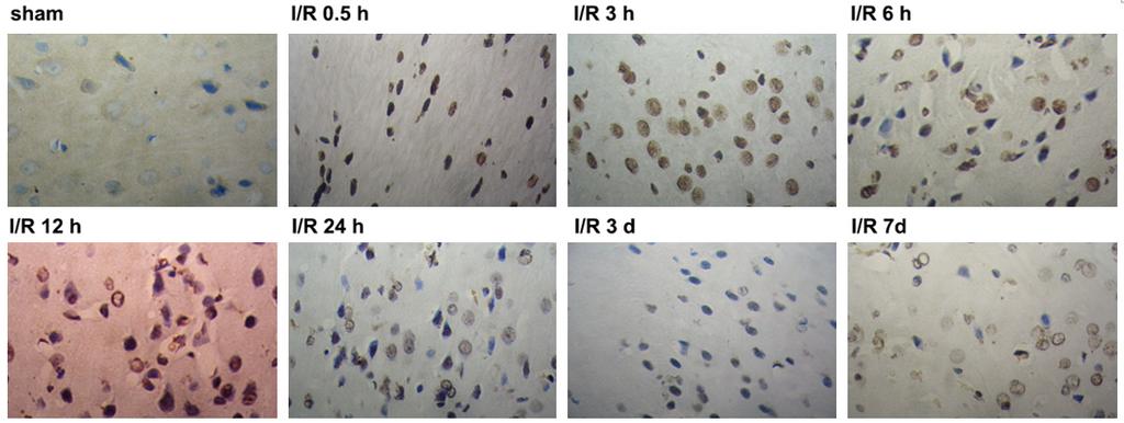 Figure 4. Ischemia reperfusion injury (IRI) induces neuronal apoptosis determined by TUNEL staining (n=5). Figure 5.