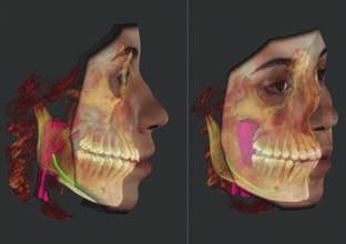 Compatible with third party software including Dolphin The Dolphin 3D imaging software is a powerful tool for orthodontists that makes processing 3D data from any Dentsply