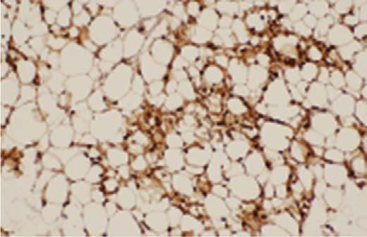 . Ucp1 Ppargc1a Prdm16 Cox7a1 Slc27a1 Cd Cd137 Klhl13 Figure 7 improves beige fat biogenesis via the inhibition of intestinal FXR-ceramide axis.