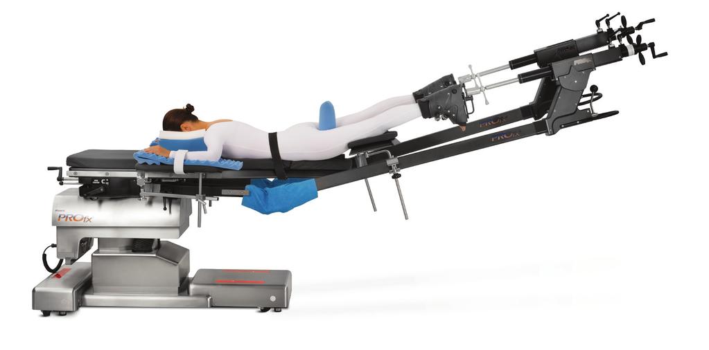 Clinical Features and Benefits Exclusive Table Maneuverability Aids surgeon with articulation of torso and legs Spars include Spherical Spatial Positioning System (SSPS) Superior Imaging Carbon fiber
