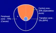 Peripheral zone (75% of glandular tissue.