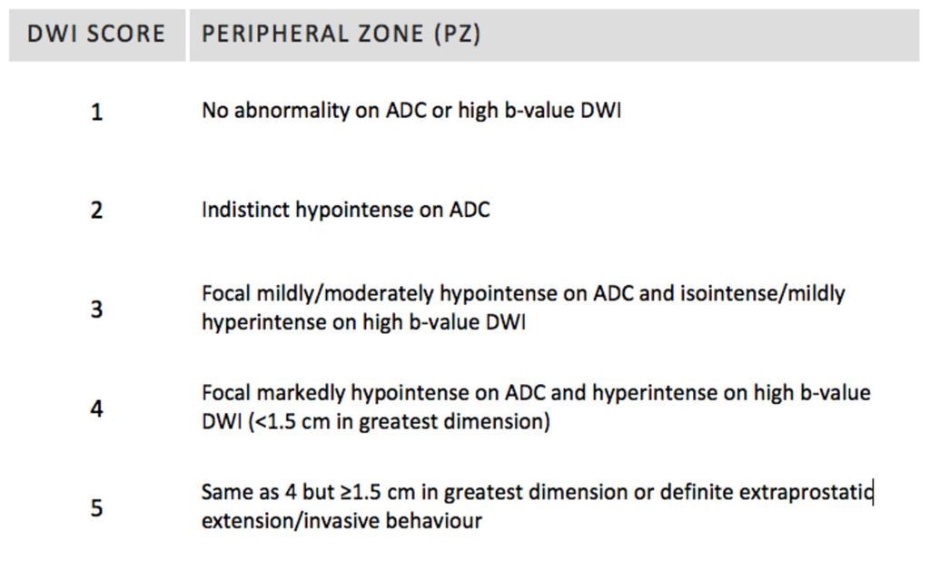 Fig. 3: DWI Score - Peripheral Zone References: - Coimbra/PT PZ lesions should be measured on ADC maps.