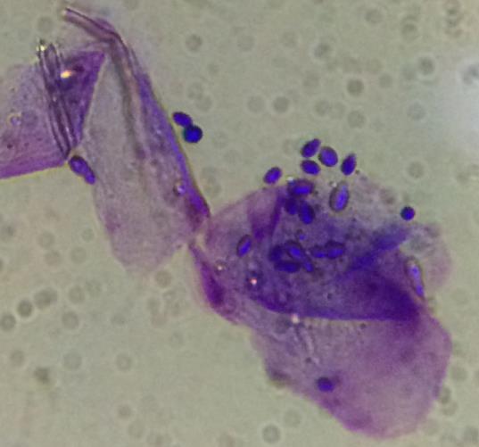 Malassezia dermatitis Malassezia hypersensitivity common in atopic dogs Number of yeast on cytology appears not proportional to