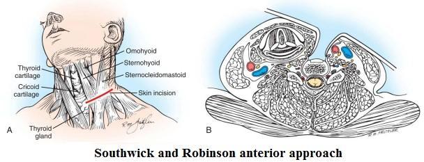 c. Inadequate exposure at the C7-T1 level through the anterior approach in individuals with a short, muscular neck. Anterior procedure: It is indicated in i. One or two segment involvement ii.