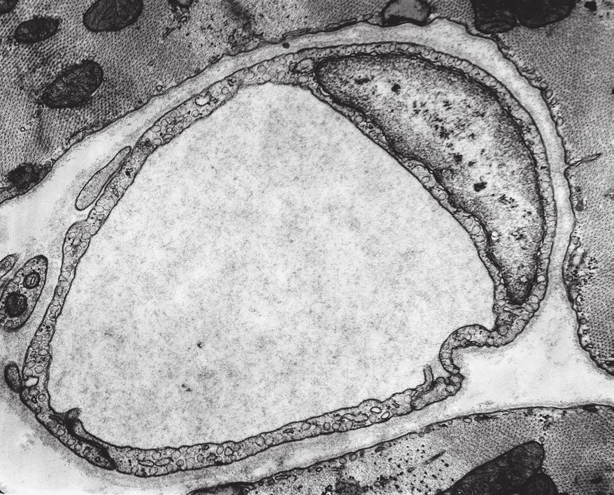 2 Fig. 2.1 is a transmission electron micrograph of a section through a blood vessel. 3 1 μm Fig. 2.1 (a) State the type of blood vessel shown in Fig.