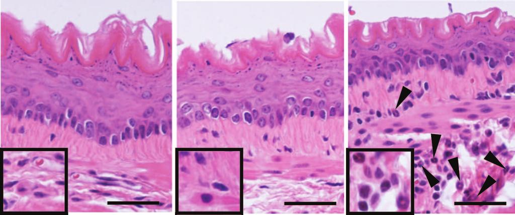 TSLP-elicited basophil responses can mediate the pathogenesis of eosinophilic esophagitis. Mario Noti, Elia D. Tait Wojno, Brian S. Kim, Mark C. Siracusa, Paul R. Giacomin, Meera G. Nair, Alain J.