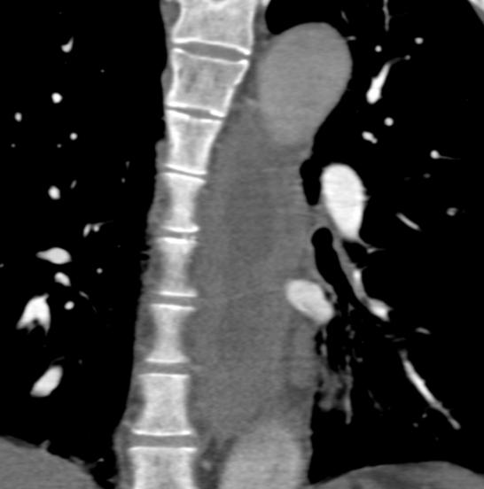 axial(c) CT images of a patient