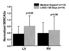 Comparison of LV & RV Response to LVAD RV myocardial efficacy is maintained by a