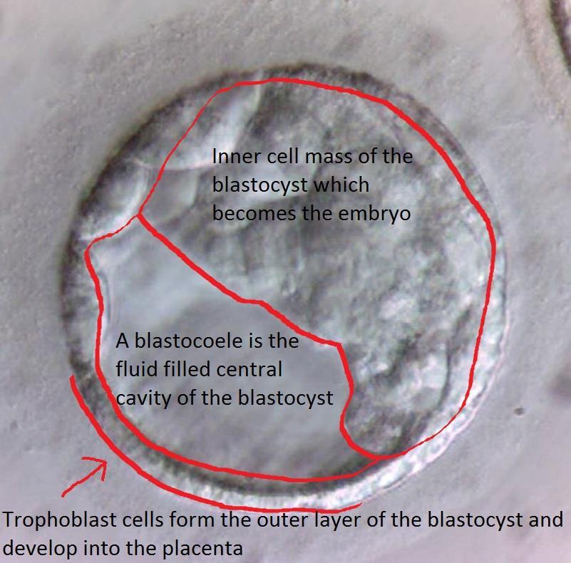 Pictures of the blastocysts http://www.fssc.com.