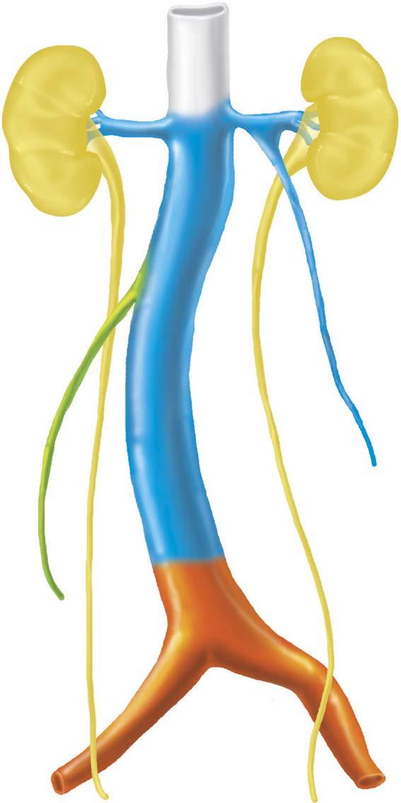 The right vitelline vein forms the hepatic segment of the IVC.