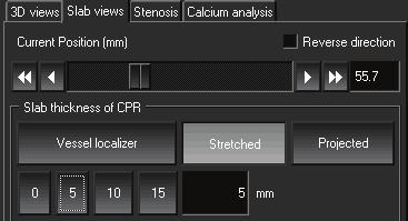 Chapter 7: User scenarios 3 To create a 5 mm slab, in the Slab thickness of CPR area, click the