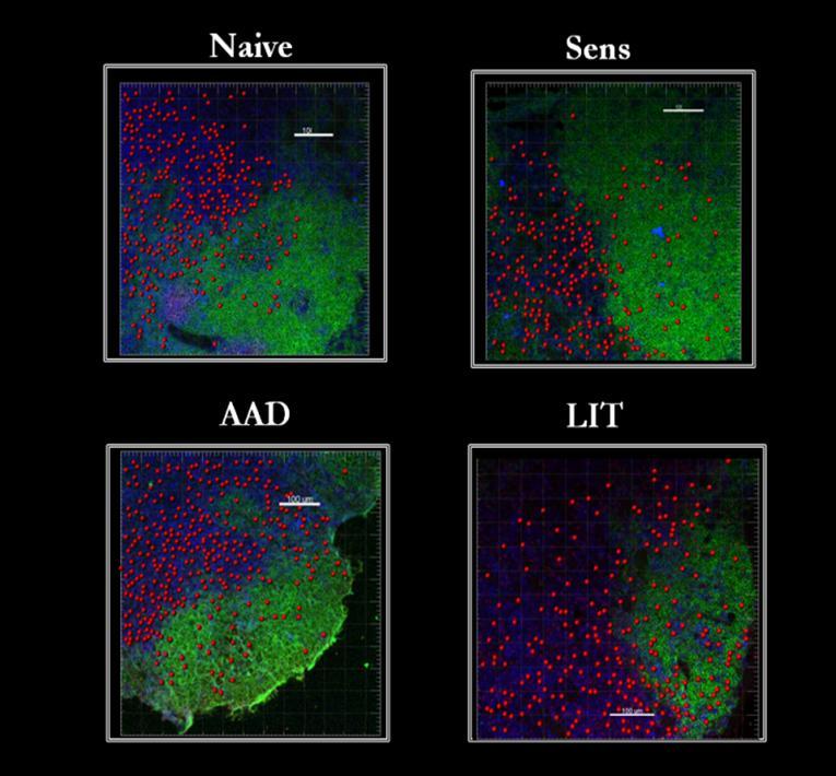 Figure 16. Localization of Foxp3 + Tregs in the different compartments of the MLN at the various stages of OVA-induced AAD via confocal microscopy.