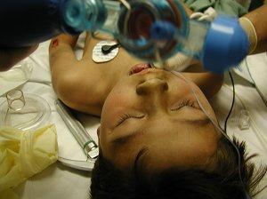3 Pediatric head trauma: what s the big deal?