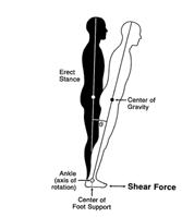 disorders of balance Normal Malingering Everything else (vestibular, central, etc) Objective measure of sway Response to rehabilitation Response to therapeutic maneuvers