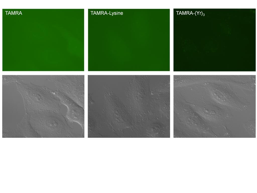 Figure S5. Localization of TAMRA, TAMRA-Lysine, and TAMRA-(Yr) 3 in HeLa cells.