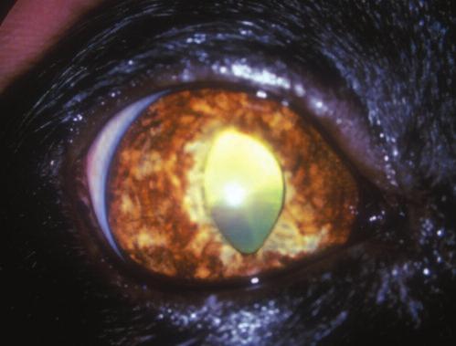 Iris hyperpigmentation and secondary glaucoma are the most common presenting signs. 29,39 Other potential clinical signs include distortion of the iris and evidence of uveitis.