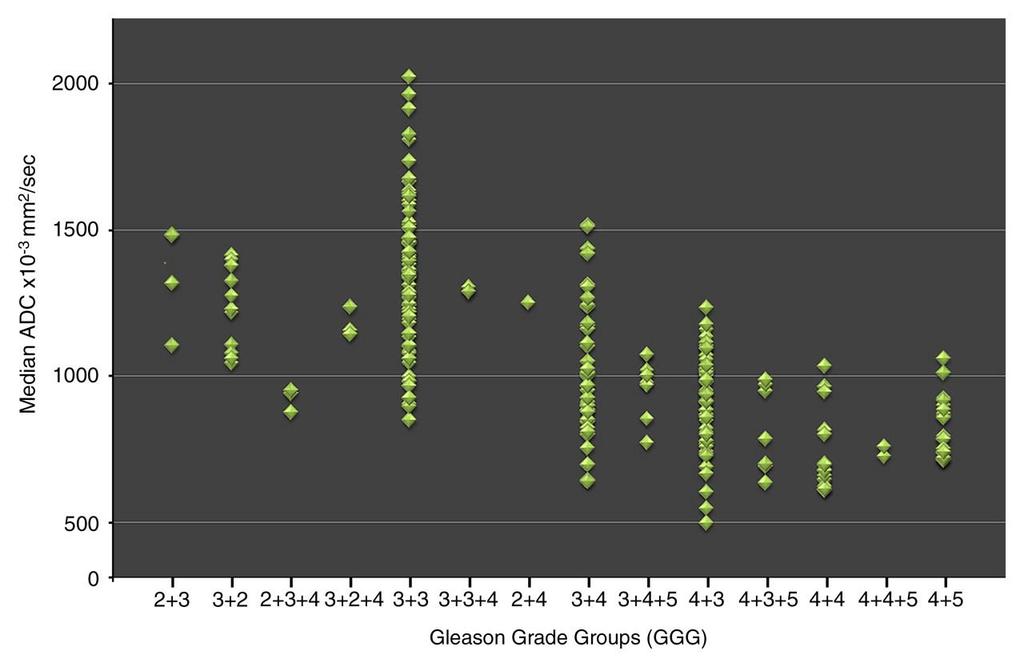 ADC Correlates with Gleason Score