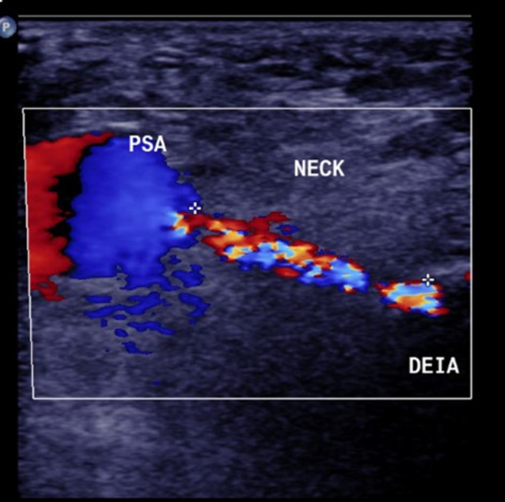 Fig. 3: Ultrasound of