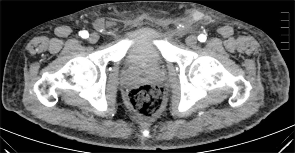 Fig. 4: CT