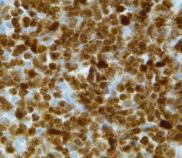 NK/T cell development NK/T cell development Stem cell NK/T cell precursor Committed NK/T cell