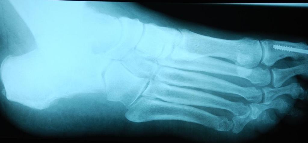 Case B (Figure 2): Medial oblique radiograph, no evidence of fracture.