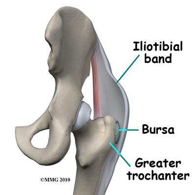 passes over the bursa on the outside of the greater trochanter. It runs down the side of the thigh and attaches just below the outside edge of the knee.