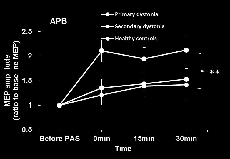 non-affected side in secondary dystonia and that there was no spread of the PAS effect to the ADM muscle on either side (Figure 6.8.). Figure 6.