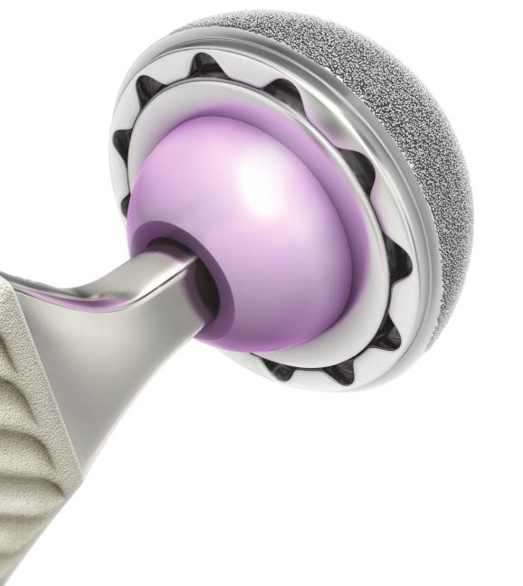 CERAMIC-ON-METAL References: 1. Beaule, P. E., et al. Jumbo femoral head for the treatment of recurrent dislocation following total hip replacement. J.Bone Joint Surg (2002). 84-A: 256-63. 2. Jolles, B.
