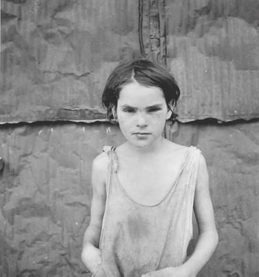 2) Dorothea Lange Damaged Child 1936 3)
