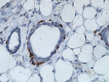 Id4 + myoepithelial cells.