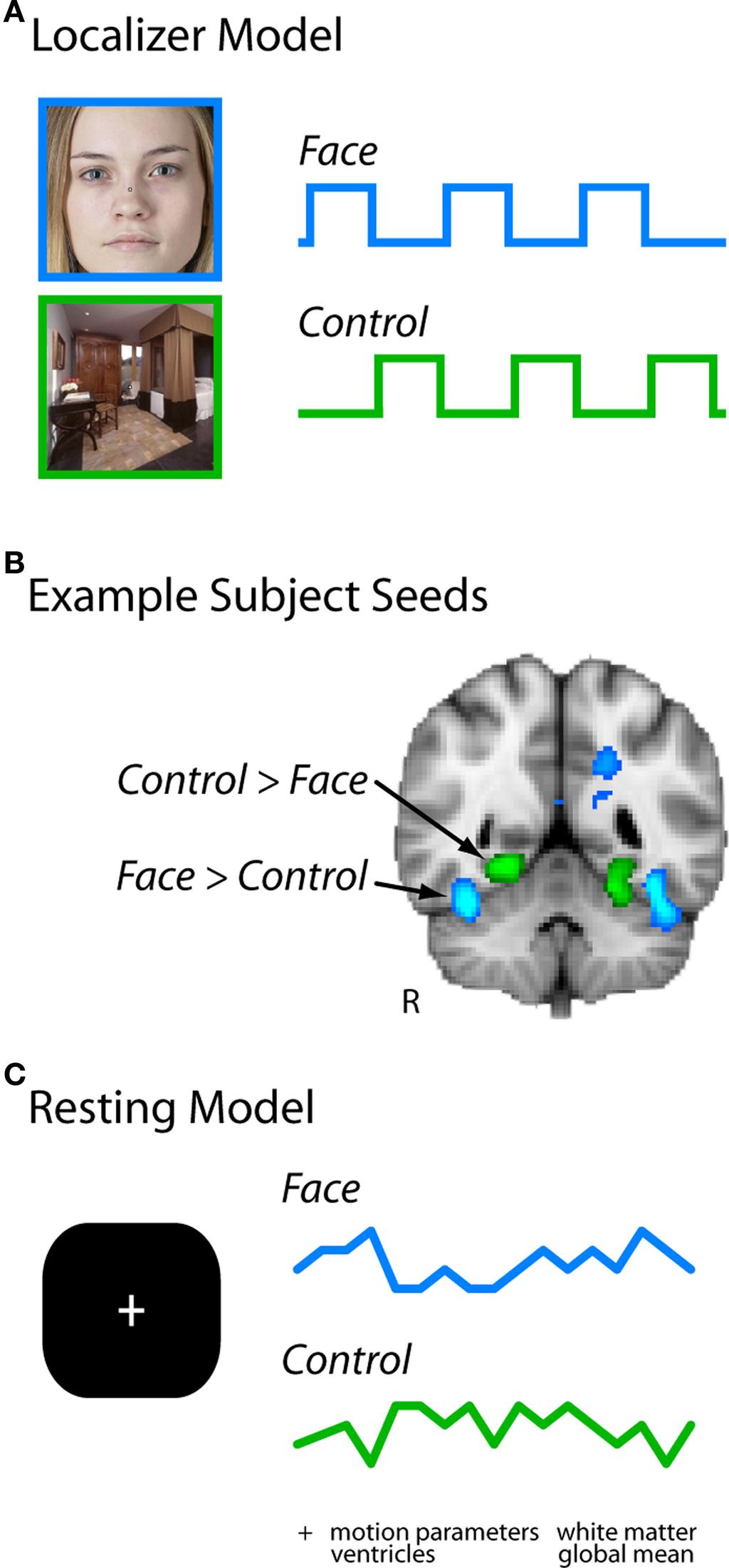 To analyze resting functional connectivity, the FG and control seeds were overlaid on the preprocessed resting data (see Figure 1).